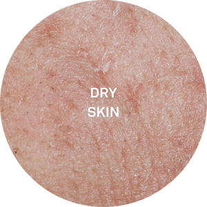 Dryness & Darkspots