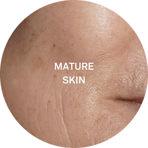 Dull and Aged Skin